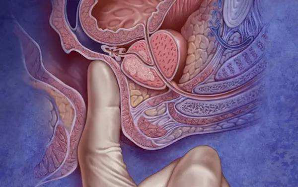 放弃菊花指检？当心肠子都悔青 广州东大医院评价