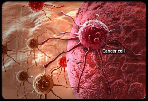 什么是直肠癌骨转移 转移了怎么办？广州东大医院骗人吗