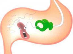 养胃的最佳方法有哪些？