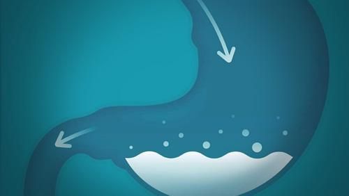 糜烂性胃炎伴胆汁返流怎么办 广州东大医院评价