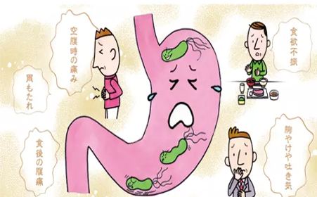 胃窦炎中度怎么办 广州东大医院收费怎么样