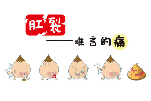 广州东大肛肠医院教你识别肛裂与几种相似病的区别